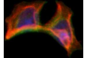 ABIN6263302 and ABIN6266595 staining Hela by IF/ICC. (Matrix Metallopeptidase 23 (MMP23) (C-Term) Antikörper)