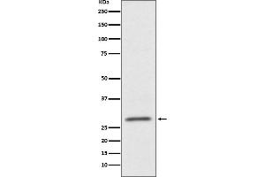 Western blot analysis of CD99 expression in HUVEC cell lysate.