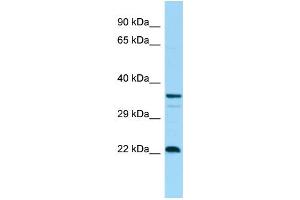 WB Suggested Anti-CD83 Antibody Titration: 1. (CD83 Antikörper  (C-Term))