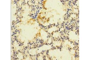 Immunohistochemistry of paraffin-embedded human lung tissue using ABIN7168904 at dilution of 1:100 (PRSS23 Antikörper  (AA 20-383))