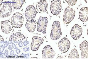 Immunohistochemical analysis of paraffin-embedded mouse testis tissue. (TUBB2A Antikörper)