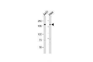 All lanes : Anti-EGFR Antibody (C-term) at 1:1000 dilution Lane 1: A431 whole cell lysate Lane 2: Hela whole cell lysate Lysates/proteins at 20 g per lane. (EGFR Antikörper  (C-Term))