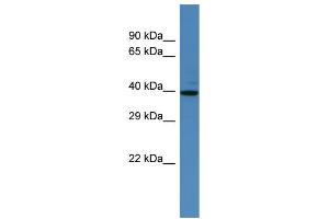 Western Blotting (WB) image for anti-Spermatogenesis Associated 2 (SPATA2) (N-Term) antibody (ABIN2774247)