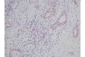 Image no. 2 for anti-KIT Ligand (KITLG) antibody (ABIN465573) (KIT Ligand Antikörper)