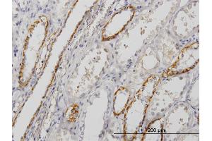 Immunoperoxidase of monoclonal antibody to PALM on formalin-fixed paraffin-embedded human kidney. (Paralemmin Antikörper  (AA 176-284))