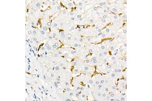 Immunohistochemistry of paraffin-embedded Human liver using Fascin/FSCN1 antibody (ABIN7267142) at dilution of 1:100 (40x lens). (Fascin Antikörper)