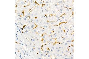 Immunohistochemistry of paraffin-embedded Human liver using Fascin/FSCN1 antibody (ABIN7267142) at dilution of 1:100 (40x lens).