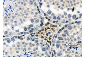 ABIN6265840 and ABIN6277615 at 1/100 staining Mouse testis tissue by IHC-P. (UBD Antikörper  (Internal Region))