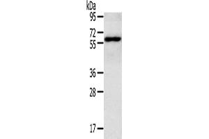 Western Blotting (WB) image for anti-RAR-Related Orphan Receptor A (RORA) antibody (ABIN2427095) (RORA Antikörper)