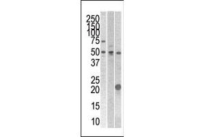 The anti- STYK1 Pab (ABIN392121 and ABIN2837982) is used in Western blot to detect STYK1 in 293 , CEM (center), and mouse kidney cell line/tissue lysates. (STYK1 Antikörper  (N-Term))