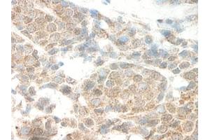 Image no. 5 for anti-Leptin (LEP) antibody (ABIN465530) (Leptin Antikörper)