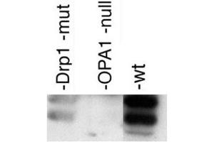 Western blot analysis of OPA1 in post-nuclear extracts of mouse embryonic fibroblasts with OPA1 polyclonal antibody . (OPA1 Antikörper  (AA 500-600))