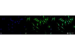 Immunocytochemistry/Immunofluorescence analysis using Rabbit Anti-Alpha B Crystallin Polyclonal Antibody . (CRYAB Antikörper  (Atto 488))