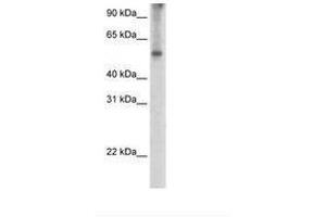 Image no. 2 for anti-Eukaryotic Translation Initiation Factor 2A, 65kDa (EIF2A) (AA 504-553) antibody (ABIN203306) (EIF2A Antikörper  (AA 504-553))