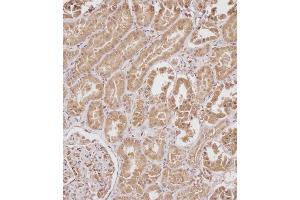 Immunohistochemistry (Paraffin-embedded Sections) (IHC (p)) image for anti-serpin Peptidase Inhibitor, Clade A (Alpha-1 Antiproteinase, Antitrypsin), Member 6 (SERPINA6) (AA 197-225) antibody (ABIN654693)