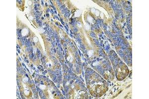 Immunohistochemistry of paraffin-embedded Mouse intestine using EIF3C Polyclonal Antibody at dilution of 1:100 (40x lens). (EIF3C Antikörper)