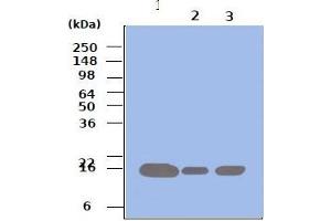 Western blot analysis: Lane 1 : 293T Lane 2 : HeLa Lane 3 : Jurkat Cell lysates of 293T, HeLa and Jurkat (each 50ug) were resolved by SDS-PAGE, transferred to PVDF membrane and probed with anti-human Pin1 (1:500). (PIN1 Antikörper)