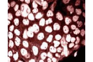 Immunofluorescence staining of phosphoserine (clone 19, MN ABIN968871) on A431 cells (Human epithelial carcinoma, ATCC CRL-1555) treated with 10 nM calyculin A and 500 nM okadaic acid. (Phosphoserine/Threonine Antikörper)