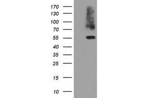 HEK293T cells were transfected with the pCMV6-ENTRY control (Left lane) or pCMV6-ENTRY PKLR (Right lane) cDNA for 48 hrs and lysed. (PKLR Antikörper)