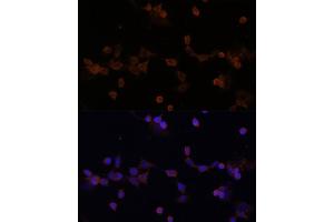 Immunofluorescence analysis of NIH-3T3 cells using UBE2L3 Polyclonal Antibody (ABIN1683196, ABIN3018653, ABIN3018655 and ABIN6220527) at dilution of 1:100 (40x lens). (UBE2L3 Antikörper  (AA 73-212))