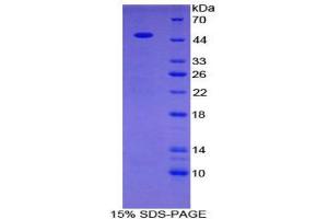 SDS-PAGE (SDS) image for Phospholipase A2, Group IIA (Platelets, Synovial Fluid) (PLA2G2A) (AA 22-146) protein (His tag,GST tag) (ABIN1879490)