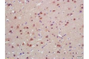Formalin-fixed and paraffin embedded rat brain labeled with Anti-SATB2 Polyclonal Antibody, Unconjugated (ABIN1385735) at 1:200, followed by conjugation to the secondary antibody and DAB staining (SATB2 Antikörper  (AA 451-485))