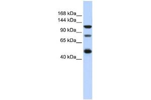 WB Suggested Anti-ZEB2 Antibody Titration:  0. (ZEB2 Antikörper  (Middle Region))