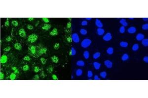 IF analysis of Hsp105 using anti-Hsp105 antibody (ABIN5693036). (HSPH1 Antikörper  (AA 653-858))