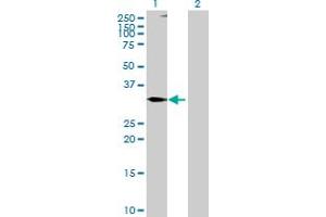 Western Blotting (WB) image for anti-Tumor Necrosis Factor (Ligand) Superfamily, Member 10 (TNFSF10) (AA 1-300) antibody (ABIN522187)