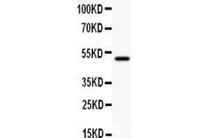 Anti- CD80 antibody,  Western blotting All lanes: Anti CD80 () at 0.