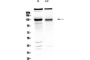 Western blot analysis of BMPR2 using anti-BMPR2 antibody . (BMPR2 Antikörper  (AA 455-512))