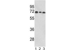 Western blot analysis of ABI1 antibody and human 1) MCF-7, 2) CEM, and 3) Jurkat lysate.