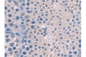 DAB staining on IHC-P; Samples: Mouse Testis Tissue (AASS Antikörper  (AA 477-926))