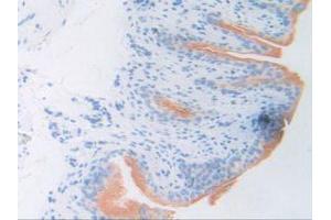 Figure. (ATF6 Antikörper  (AA 1-377))