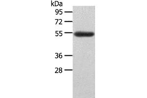 Western Blotting (WB) image for anti-Lymphocyte-Activation Gene 3 (LAG3) antibody (ABIN2431575)