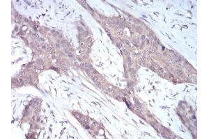 Immunohistochemistry (IHC) image for anti-NADPH Oxidase 4 (NOX4) (AA 210-310) antibody (ABIN5872374) (NADPH Oxidase 4 Antikörper  (AA 210-310))