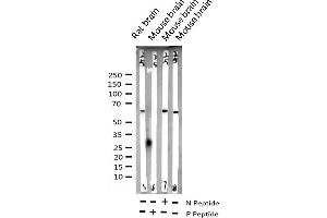 Western blot analysis of Phospho-p62 Dok (Tyr398) expression in various lysates (DOK1 Antikörper  (pTyr398))