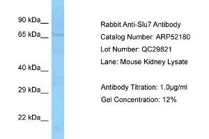 Western Blotting (WB) image for anti-SLU7 Splicing Factor Homolog (SLU7) (Middle Region) antibody (ABIN2774006) (SLU7 Antikörper  (Middle Region))