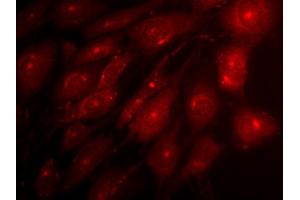 Indirect immunofluorescence on 3T3 cells (dilution 1 : 500) in combination with a Cy3 labeled secondary antibody (dilution 1 : 500). (Syntaxin 12/13 (AA 1-250) Antikörper)