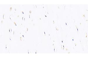 Immunohistochemistry (IHC) image for anti-Bone Morphogenetic Protein 2 (BMP2) (AA 24-395) antibody (ABIN7440320)