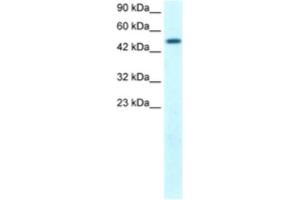 Western Blotting (WB) image for anti-FLT3-Interacting Zinc Finger 1 (FIZ1) antibody (ABIN2460146) (FIZ1 Antikörper)