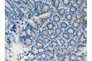 Detection of CASP8 in Mouse Colon Tissue using Polyclonal Antibody to Caspase 8 (CASP8) (Caspase 8 Antikörper  (AA 219-376))
