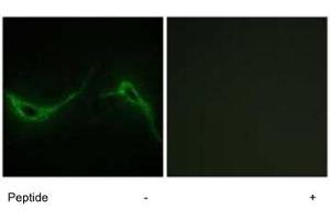 Immunofluorescence analysis of NIH/3T3 cells, using ADCY7 polyclonal antibody . (ADCY7 Antikörper)