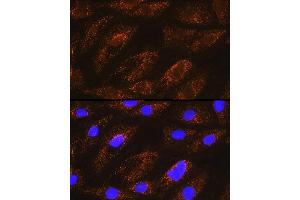Immunofluorescence analysis of H9C2 cells using NDUF Rabbit pAb (ABIN6132401, ABIN6144467, ABIN6144468 and ABIN6215694) at dilution of 1:100 (40x lens). (NDUFA8 Antikörper  (AA 33-172))
