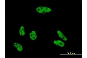 Immunofluorescence (IF) image for anti-Vacuolar Protein Sorting 72 Homolog (S. Cerevisiae) (VPS72) (AA 1-364) antibody (ABIN563124)