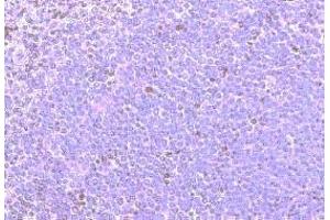 Immunohistochemistry on paraffin section of human spleen (CCRD6 (Extracellular Domain), (N-Term) Antikörper)