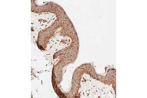 Immunohistochemical analysis of paraffin-embedded human skin tissue using C performed on the Leica® BOND RXm. (ALOXE3 Antikörper  (AA 223-252))