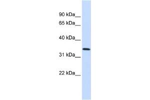 WB Suggested Anti-ANXA4 Antibody Titration:  0. (Annexin IV Antikörper  (Middle Region))