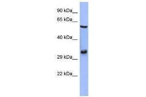 WB Suggested Anti-FOSL1 Antibody Titration:  0. (FOSL1 Antikörper  (Middle Region))