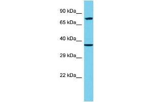 Host: Rabbit Target Name: EPN3 Sample Type: 293T Whole Cell lysates Antibody Dilution: 1. (EPN3 Antikörper  (C-Term))